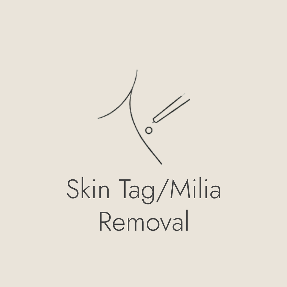 MILIA REMOVAL