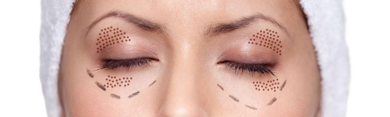 Skin Boosters & Polynucleotides